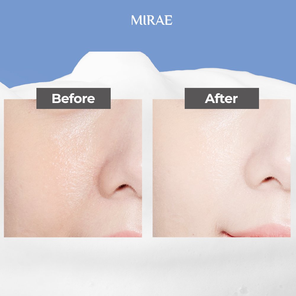 Sữa Rửa Mặt MIRAE làm dịu, dưỡng da trắng sáng | BigBuy360 - bigbuy360.vn