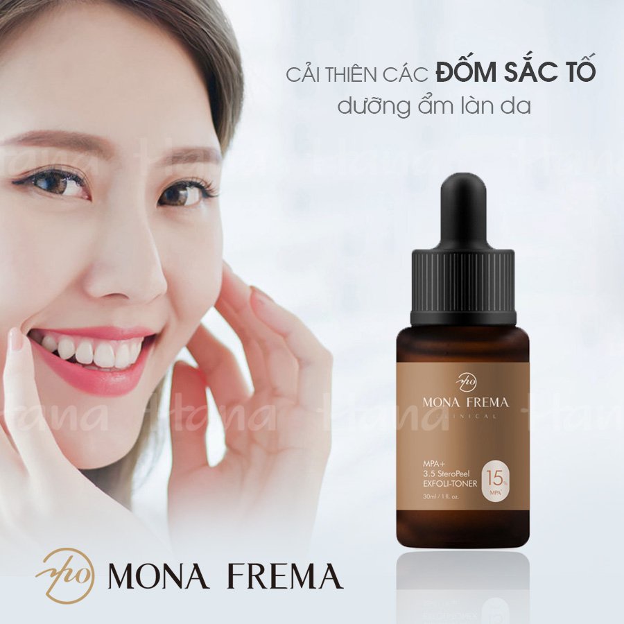 Toner tẩy tế bào chết Mona Frema MPA 15% + 3.5 SteroPeel Exfoli giảm mụn sáng căng bóng da 30ml