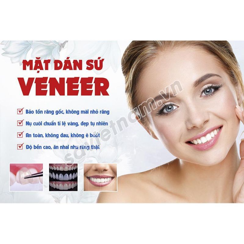 Tranh poster nha khoa tư vấn các chủ đề: răng sứ, implant, chỉnh nha, tẩy trắng,trám răng...