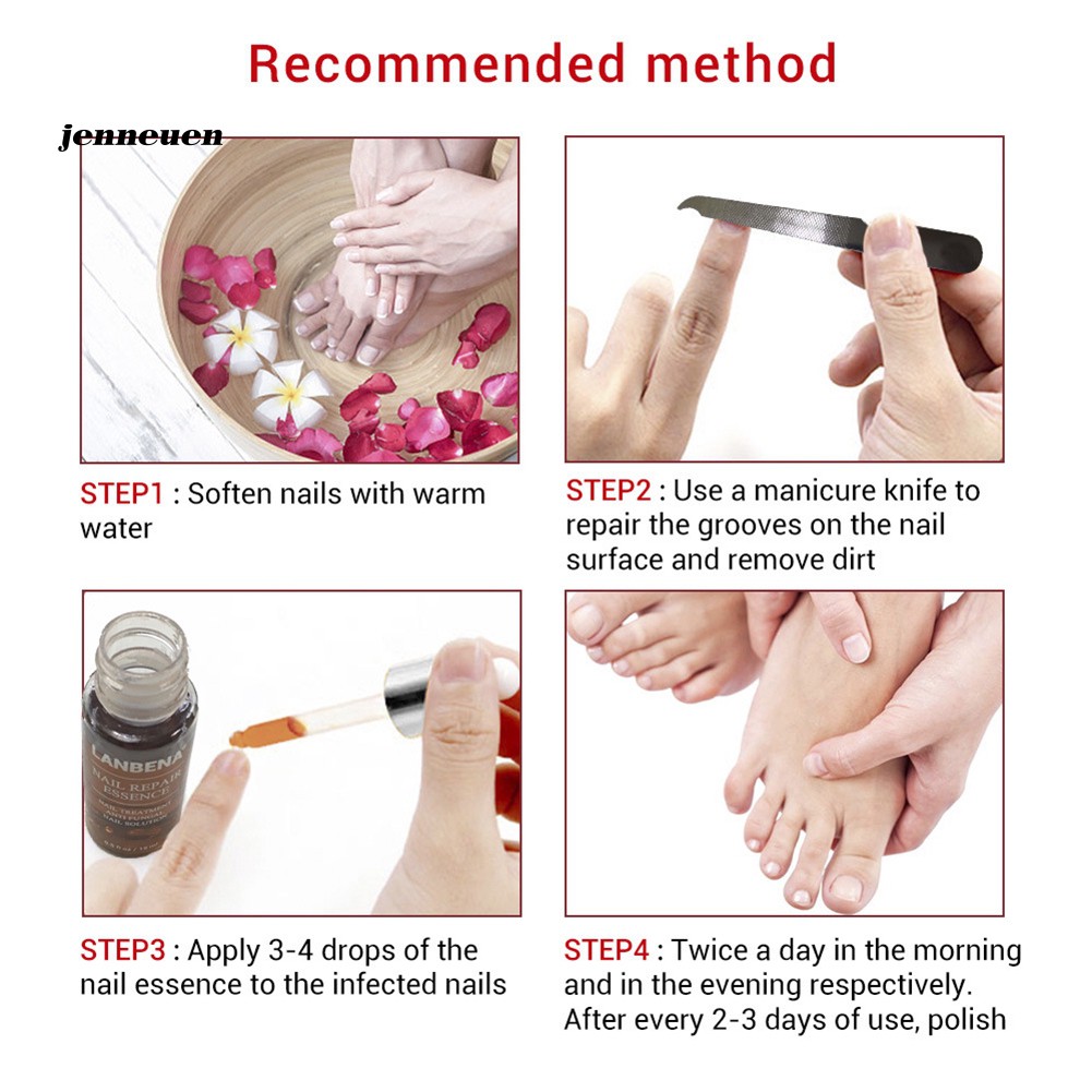 [Hàng mới về] Tinh chất phục hồi móng tay chống nấm 15ml | BigBuy360 - bigbuy360.vn