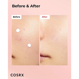 [SALE DAETE T10/2025] Chấm mụn COSRX BLEMISH SPOT DRYING LOTION