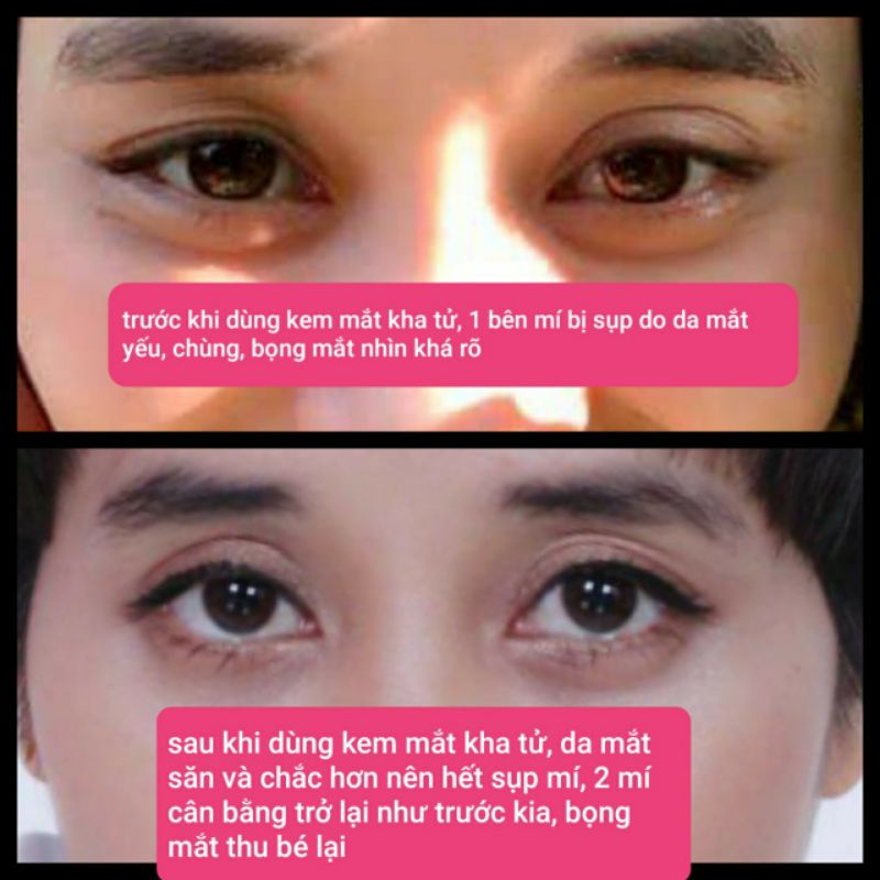 Kem Mắt Kha Tử