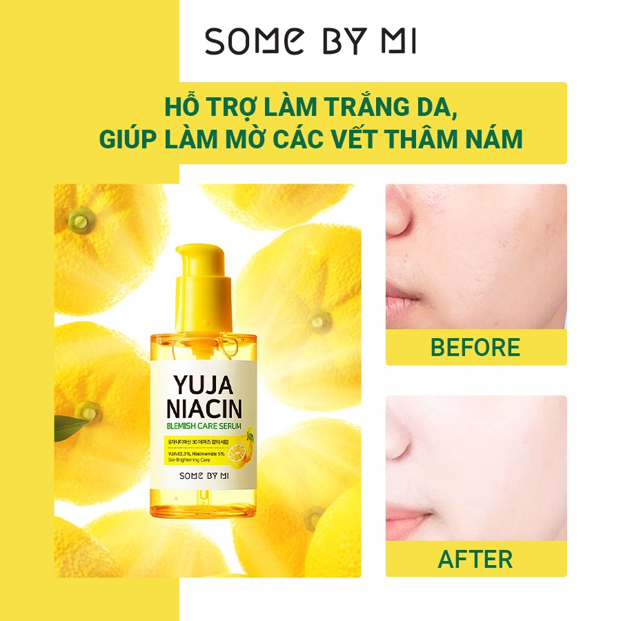 Tinh Chất Dưỡng Trắng Chiết Xuất Quả Thanh Yên SomeByMi Yuja Niacin 30 Days Blemish Care 50ml