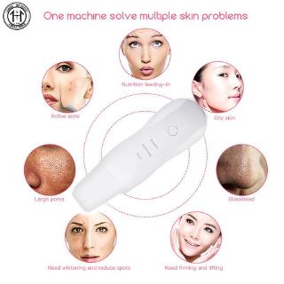 Dụng cụ nặn mụn đầu đen hiệu quả