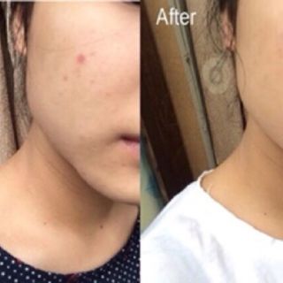 Serum dương da Melano CC Vitamin C - 20ml