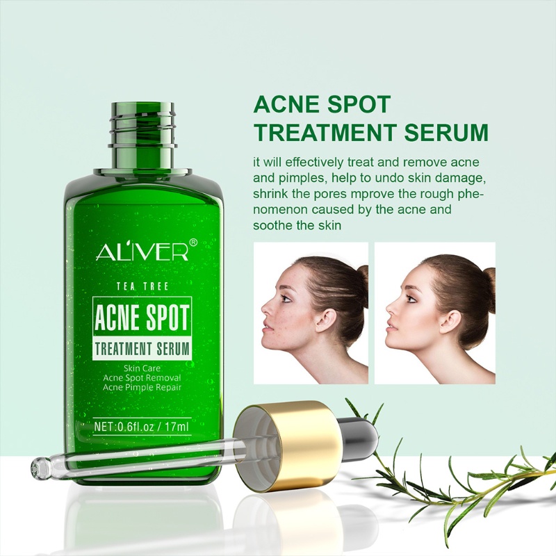 XIXI Serum Hỗ Trợ Giảm Mụn Chiết Xuất Tràm Trà Làm Sạch Da Hiệu Quả
 | BigBuy360 - bigbuy360.vn