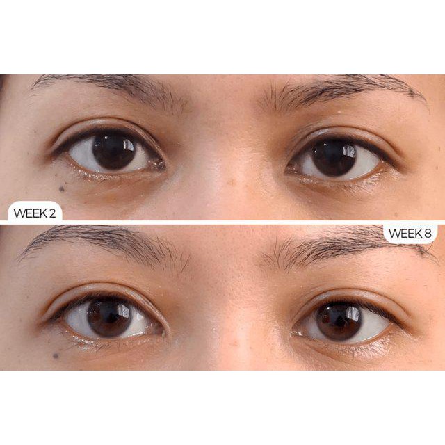 Serum The Ordinary Caffeine Solution 5% + EGCG - Tinh chất giảm quần thâm mắt ( 30mL ) | BigBuy360 - bigbuy360.vn