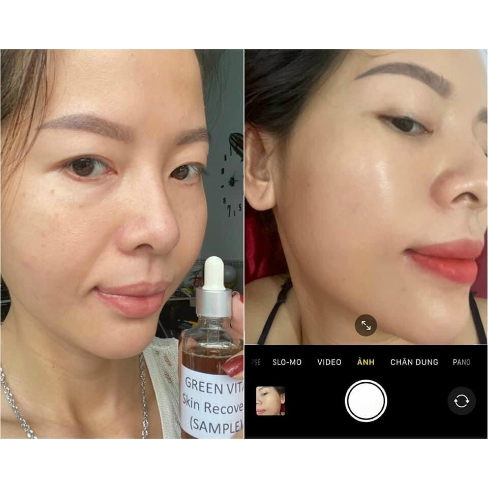 Siêu vi tảo Green Vita -  tái sinh da siêu vi tảo Nhật (TẶNG KÈM GHIM CÀI ÁO CỰC YÊU) | BigBuy360 - bigbuy360.vn