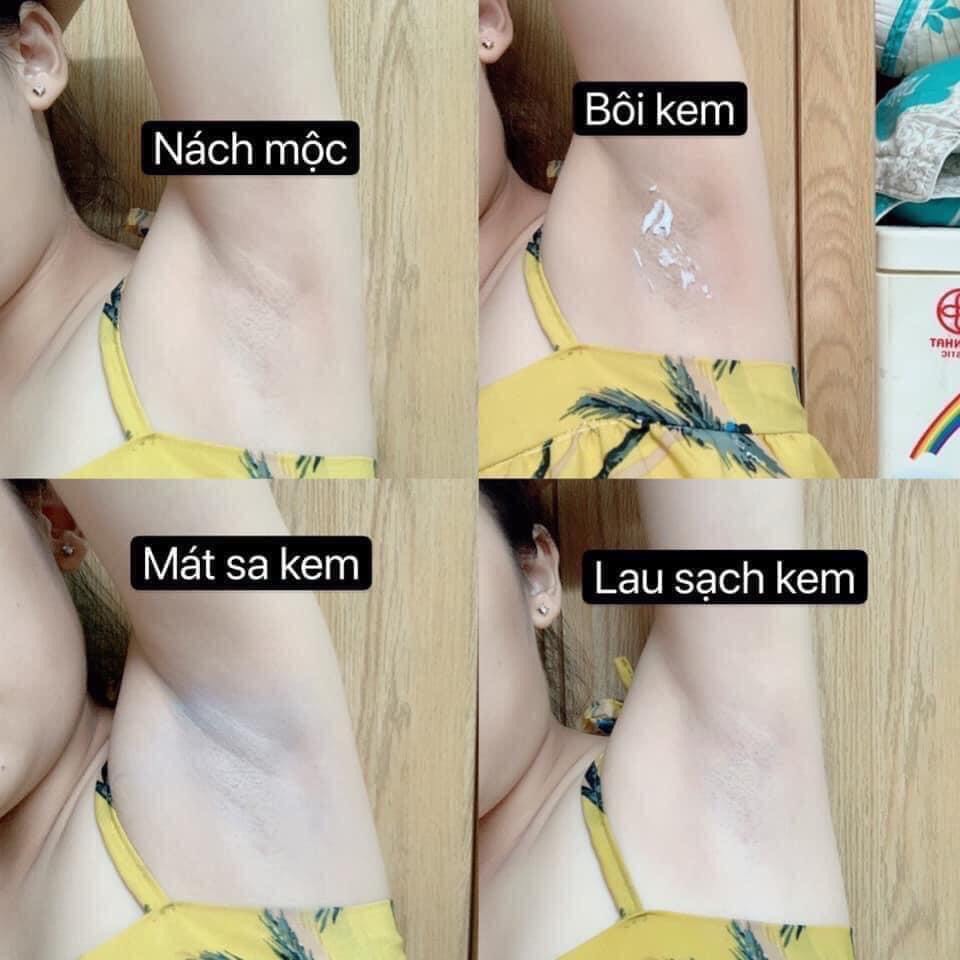 Zenpali chuối cấy trắng Whitening Detox Cream.Chuối thải chì Zenpali giảm thâm mông, nách, bẹn | BigBuy360 - bigbuy360.vn