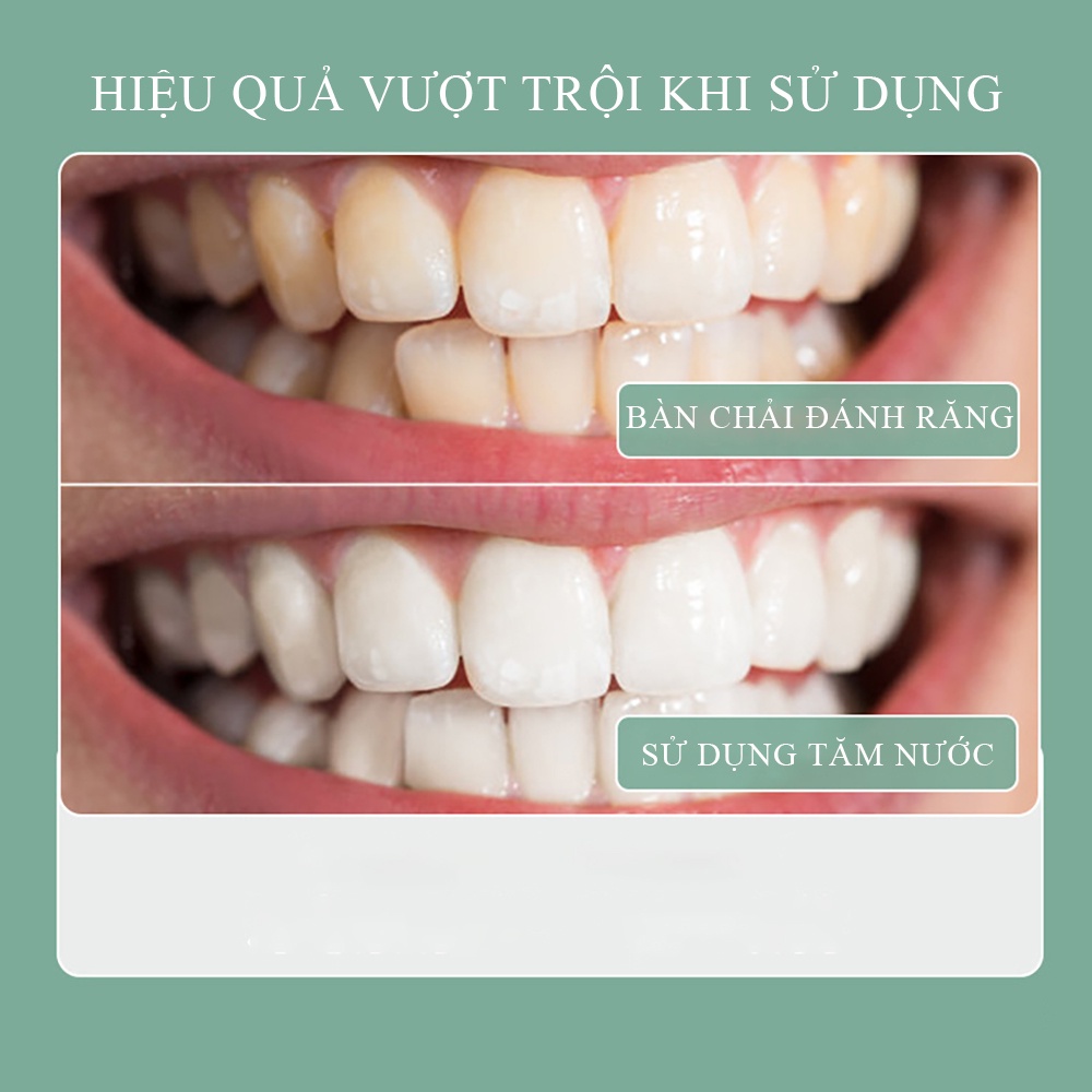 Máy Tăm Nước Cầm Tay Vệ Sinh Răng Miệng Oral Irrigator - Sạc Pin, Chống Nước, 4 Đầu Vệ Sinh Bảo Hành 24 Tháng