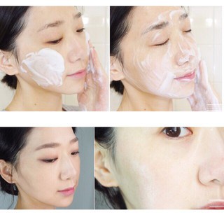 Sữa Rửa Mặt Cosrx Salicylic ACID Daily Gentle Cleanser Dành Cho Da Dầu Mụn 150ml