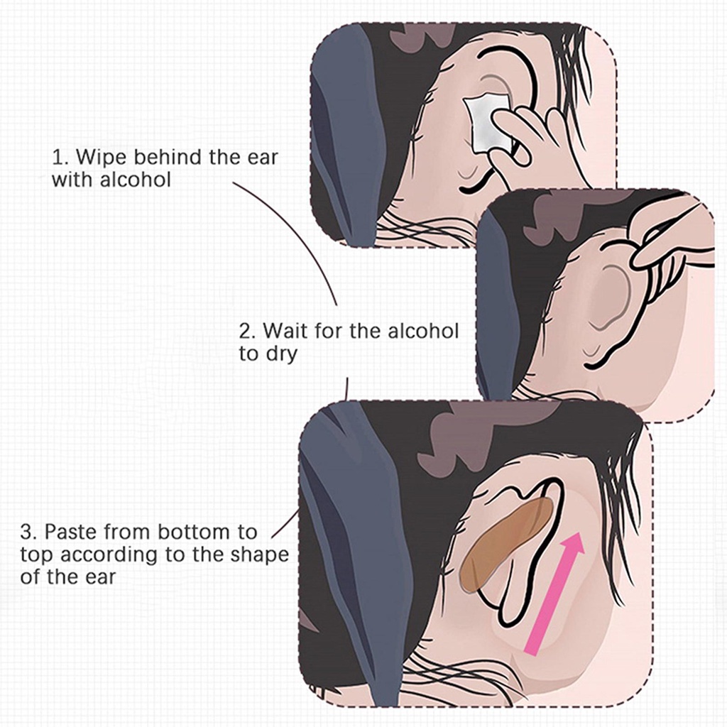 Miếng Dán Chỉnh Sửa Tai Yêu Tinh Vô Hình 12/18/24/30 #Y9B2