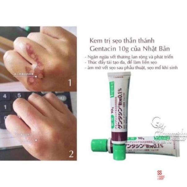 Kem sẹo Gentacin Nhật Bản 10gr