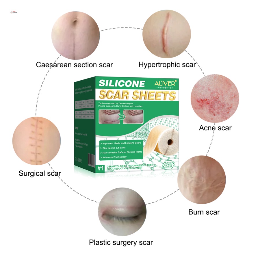 Miếng dán xóa mờ sẹo bằng gel silicone tái sử dụng ALIVER