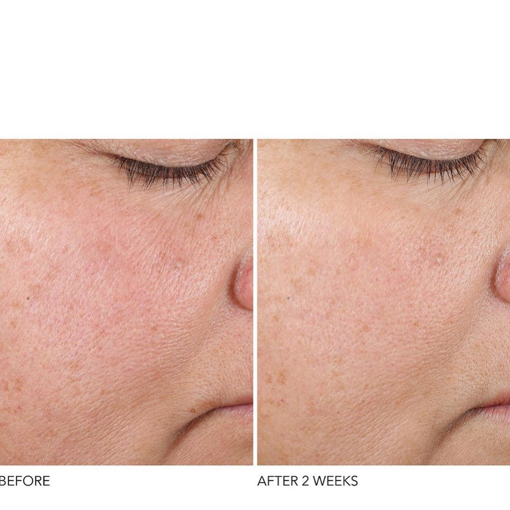 Tinh Chất Dr Dennis Gross Retinol + Ferulic Texture Renewal Serum 7ml