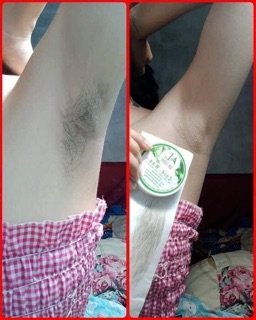 Wax Lông An Lành(tặng giấy+2 que wax)