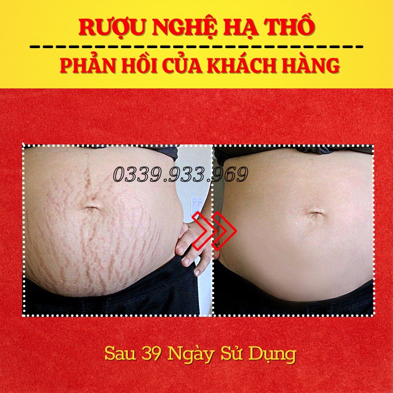 Combo Sau Sinh: Muối Thảo mộc + Rượu Gừng &amp; Nghệ Hạ Thổ 3 Năm + Tặng Đai Quấn Cho Mẹ Sau Sinh I'm Nature