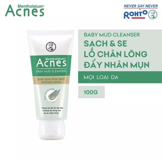 Acnes Baby Mud - Bùn non rửa mặt dưỡng sáng da 100g