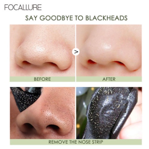 Miếng dán lột mụn FOCALLURE làm sạch sâu hỗ trợ giảm mụn đầu đen cho vùng mũi | BigBuy360 - bigbuy360.vn
