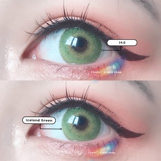 <CÓ SẴN> Lens teen Iceland, độ ẩm cao (có ảnh thật)