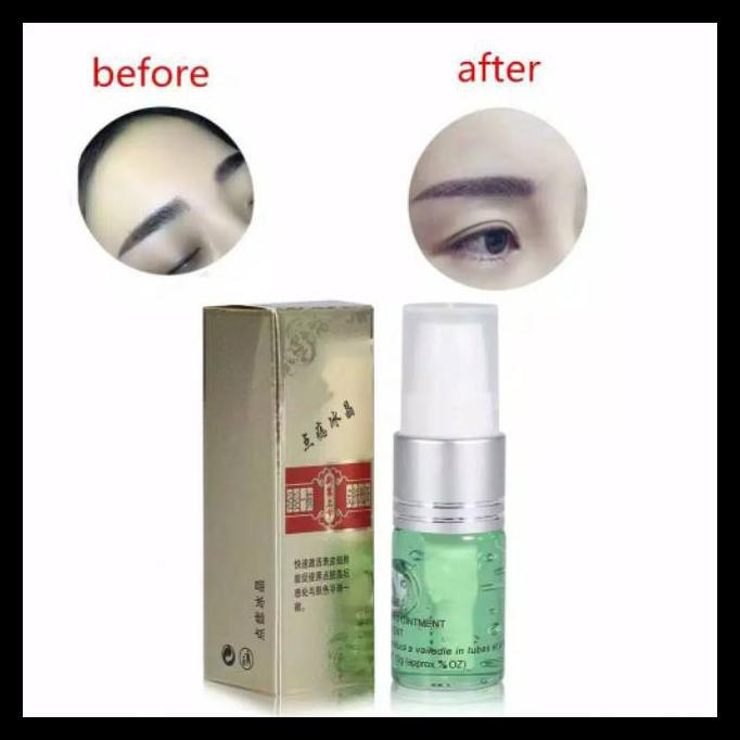 (hàng Mới Về) Serum Trị Mụn / Tàn Nhang / Đốm Đen / Nếp Nhăn Chiếu Laser Pasca