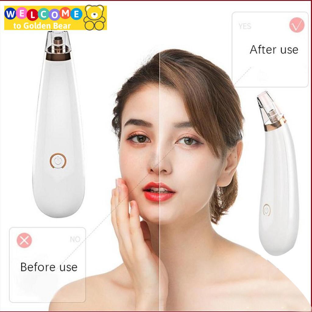 Máy Hút Mụn Mini🌹FREESHIP🌹 Giúp Hút Mụn Đầu Đen Và Mụn Ẩn Dưới Da | BigBuy360 - bigbuy360.vn