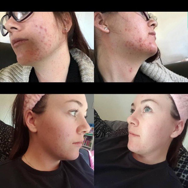 Nước hoa hồng The Ordinary Glycolic Acid 7% Toning Solution | BigBuy360 - bigbuy360.vn