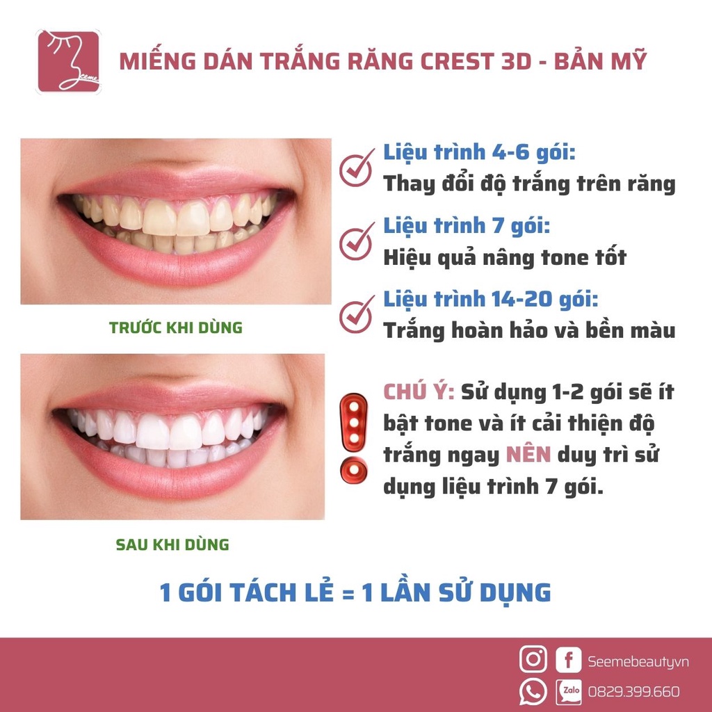 Miếng Dán Trắng Răng Crest 3D White Glamorous - Professional - 1 Hour - Charcoal SeeMebeauty