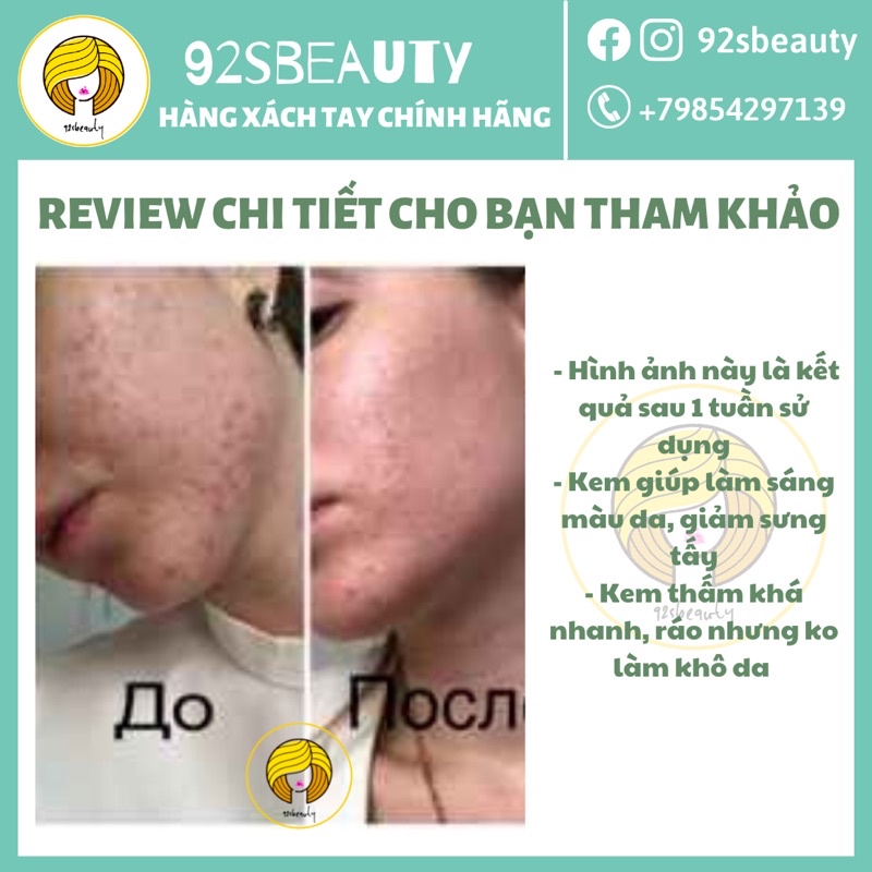 Kem bôi giảm mụn Sos Nga Propeller giúp gom cồi mụn, giảm sưng mụn