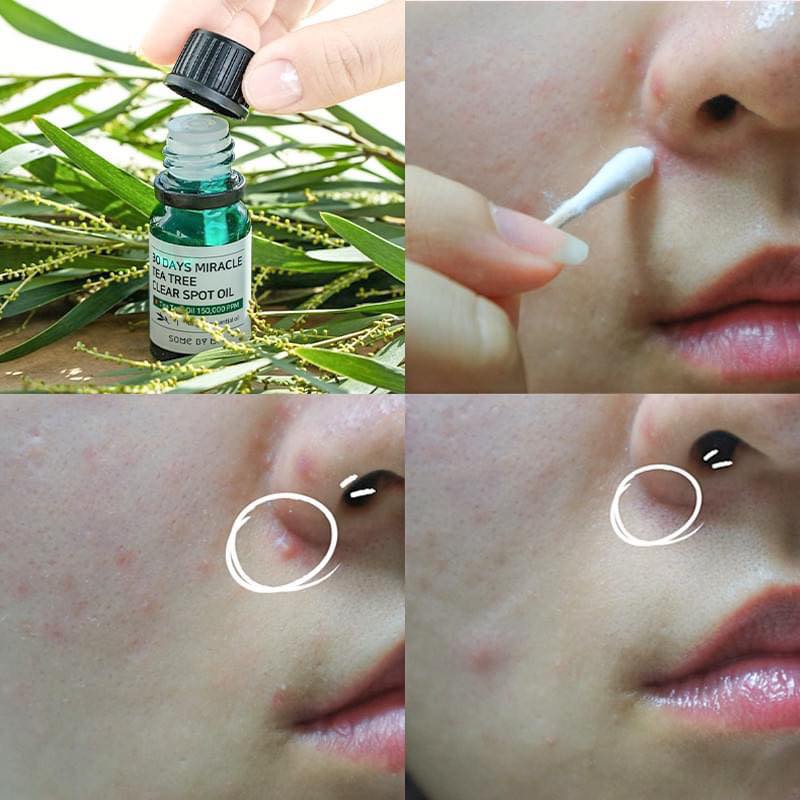 Tinh Dầu Tràm Trà Chấm Mụn Some By Mi 30 Days Miracle Tea Tree Clear Spot Oil 10ml