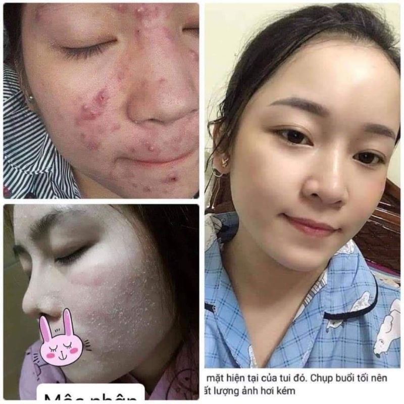 Đông Y Mộc Nhân Tái Tạo Da Thiên Nhiên Lọ 100ml