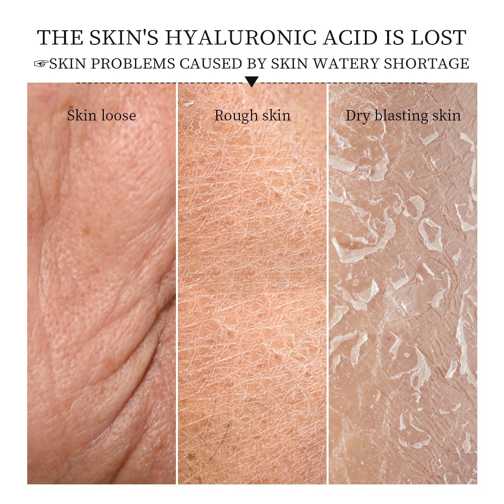 Mặt Nạ VIBRANT GLAMOUR Chiết Xuất Axit Hyaluronic Thu Nhỏ Lỗ Chân Lông Làm Trắng Và Săn Chắc Da Giữ Ẩm Chống Lão Hóa | BigBuy360 - bigbuy360.vn