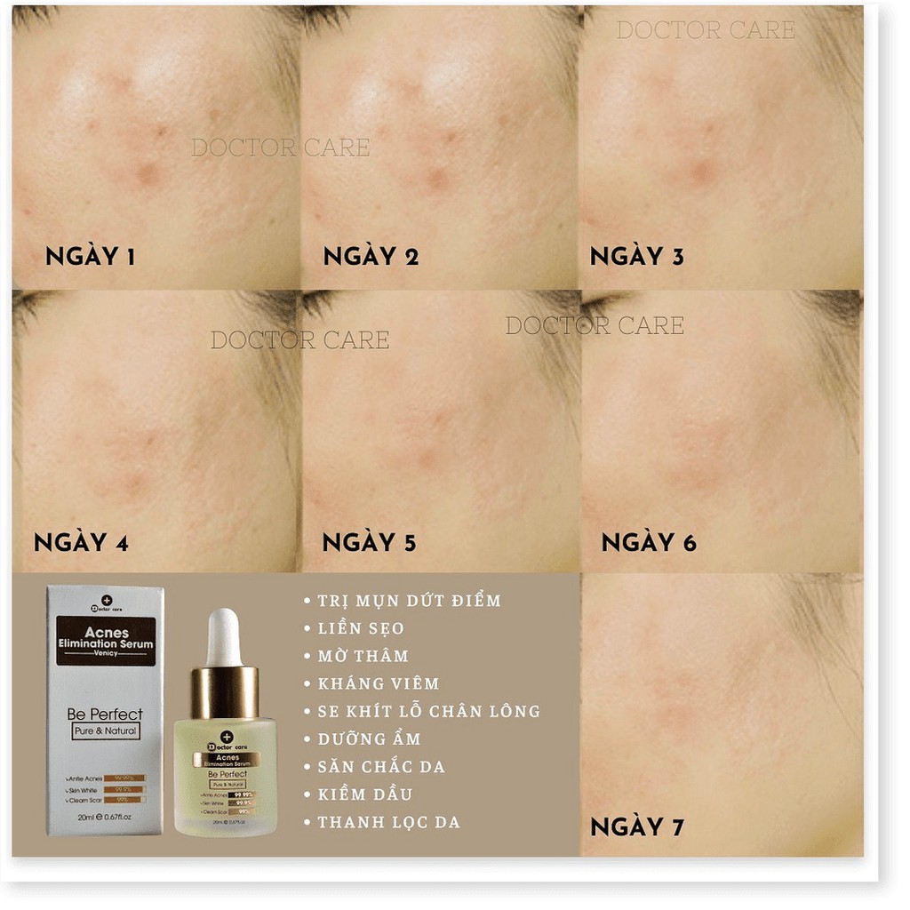 Tinh Chất DAC TRI MUN ẨN cấp tốc 7 ngay sạch mụn Doctor Care-Tinh Chất CHUYÊN TRI MUN | BigBuy360 - bigbuy360.vn