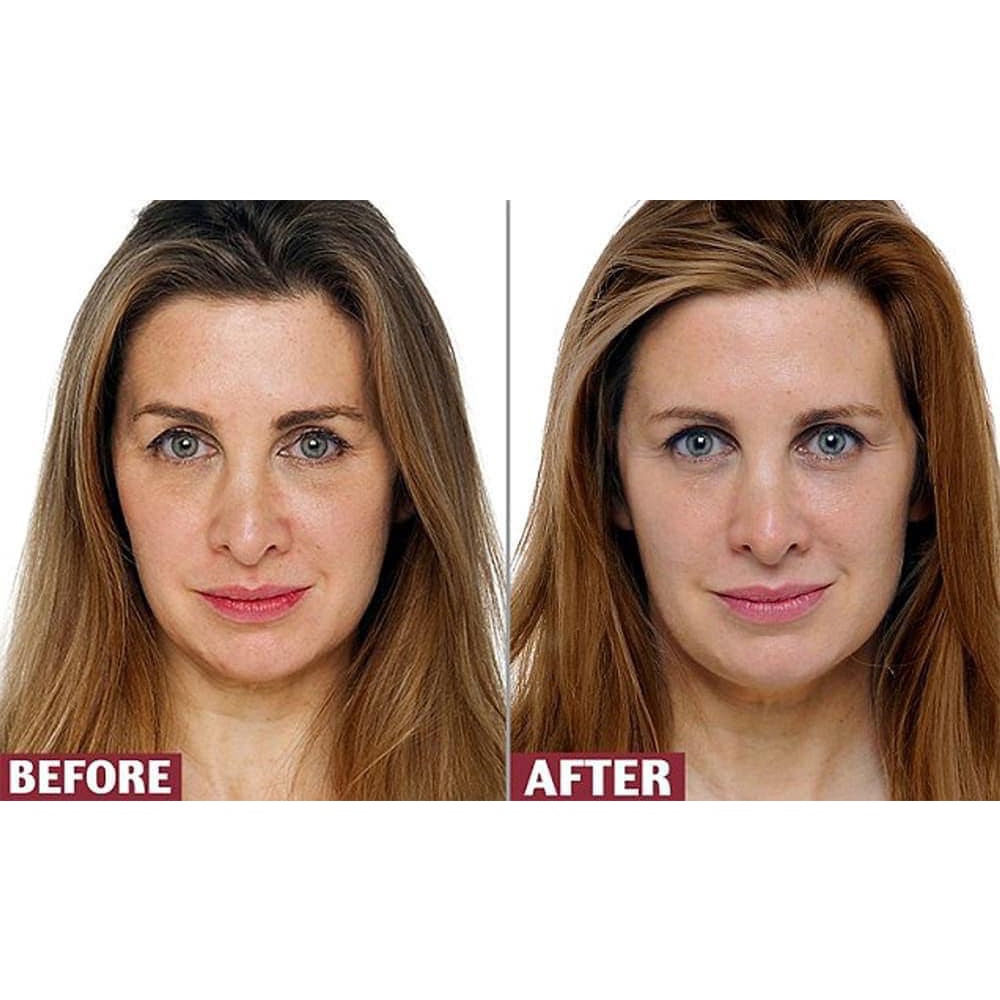 Viên Uống Retinol Myvitamins UK Hộp 90 viên giảm lão hóa giúp đẹp da