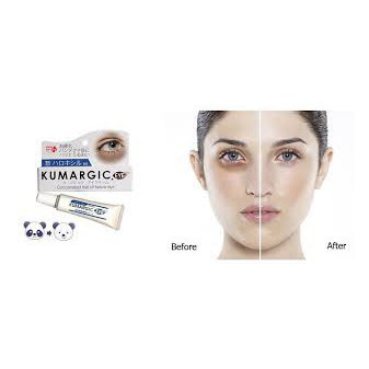 Kem trị quầng thâm mắt Kumargic Eye Nhật 20g