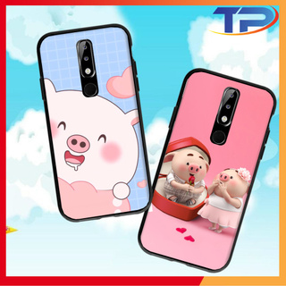 Ốp lưng Nokia 3 / 3.1 / 3.1 Plus / 5 / 5.1 Plus / 6 / 6.1 Plus / 7.2 / 8.1 Heo Con Dễ Thương 02