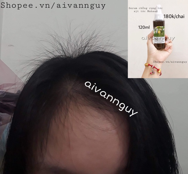 Serum dưỡng tóc Mahaad nội địa Thái | BigBuy360 - bigbuy360.vn