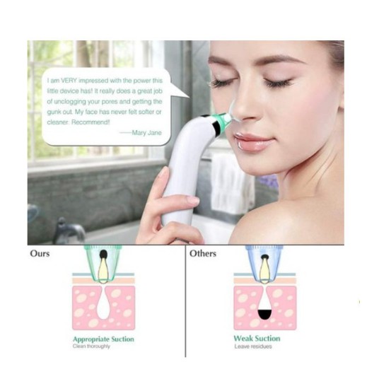 [Siêu Hot] Máy Hút Mụn Cầm Tay Derma Suction Cao Cấp 4 đầu