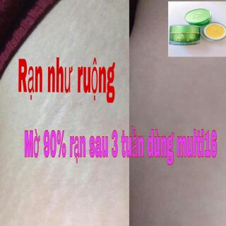 KEM TRỊ RẠN MULTI16