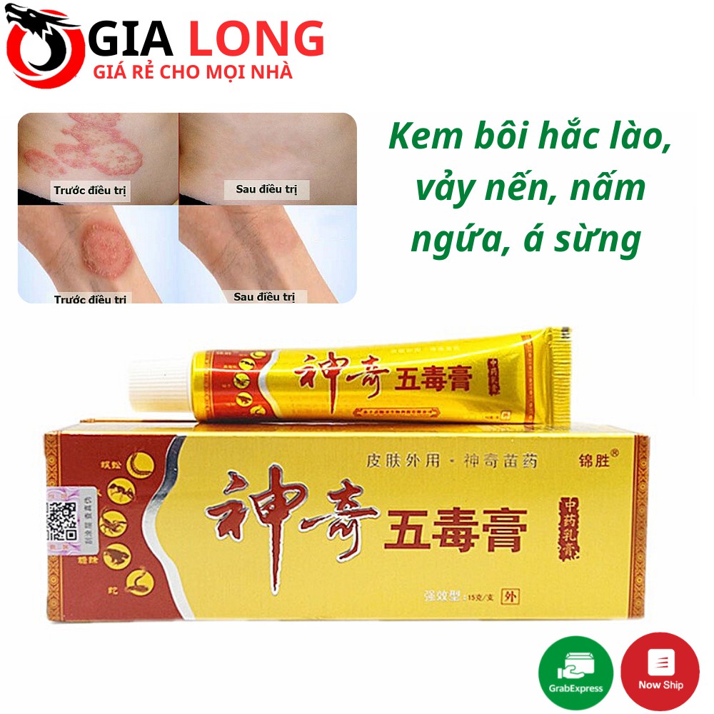 Kem bôi hắc lào, vảy nến, nấm ngứa, á sừng (V)