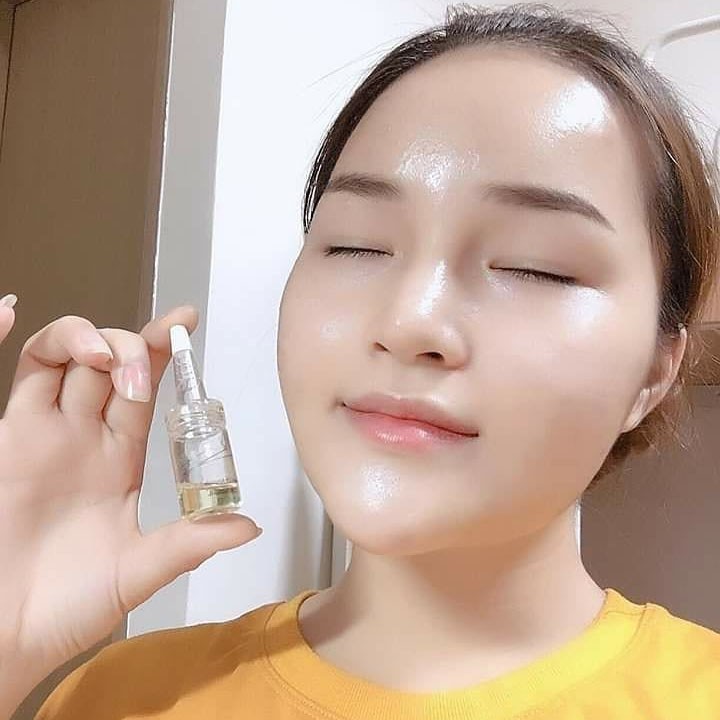 Chitossil Hàn Quốc-Cấy Chỉ Tơ Tằm, Cấy Căng Bóng Da