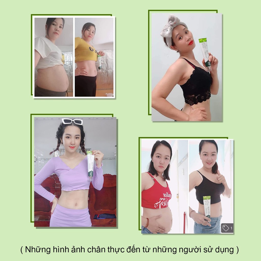 Kem tan mỡ bụng LIPOSLIM GEL kem giảm mỡ bụng dùng cho cả mẹ bầu sau sinh NAG