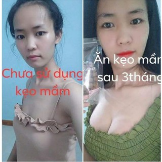 Kẹo mầm lúa mạch