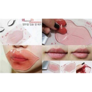 Mặt nạ môi Choosy