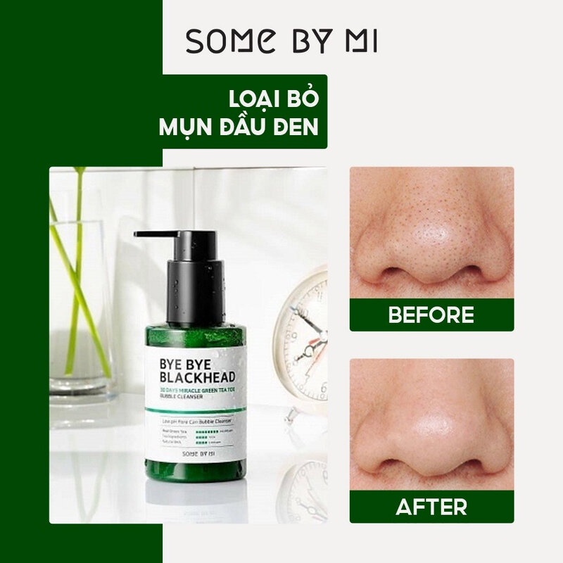 Sữa Rửa Mặt Some By Mi Sủi Bọt Giảm Mụn Bye Bye Blackhead 30Days Miracle Green Tea Tox Bubble Cleanser 120g - Khongcoson