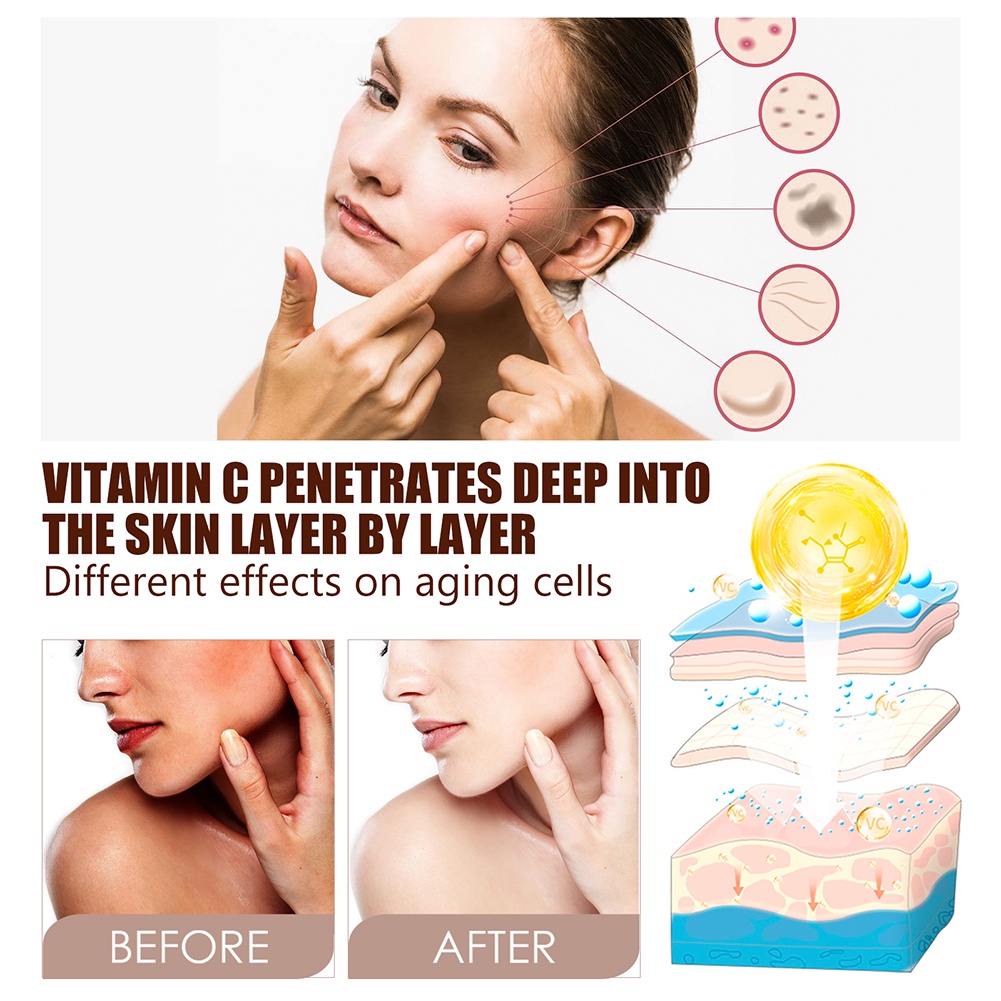 Vitamin C Phai Tại Chỗ Huyết Thanh Giữ Ẩm Tại Chỗ Loại Bỏ Mụn Trứng Cá Sáng Da Toneserum
