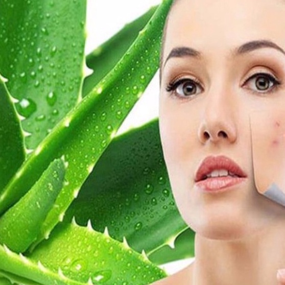 kem giảm mụn NC Nga gel lô hội giảm mụn ẩn mụn đầu đen mụn trứng cá mụn cám se khít lỗ chân lông cam kết hết mụn..