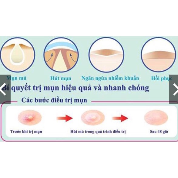 Miếng dán mụn Mayan care