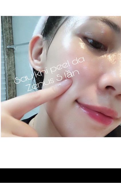 Peel TCA Zenus 50% | BigBuy360 - bigbuy360.vn