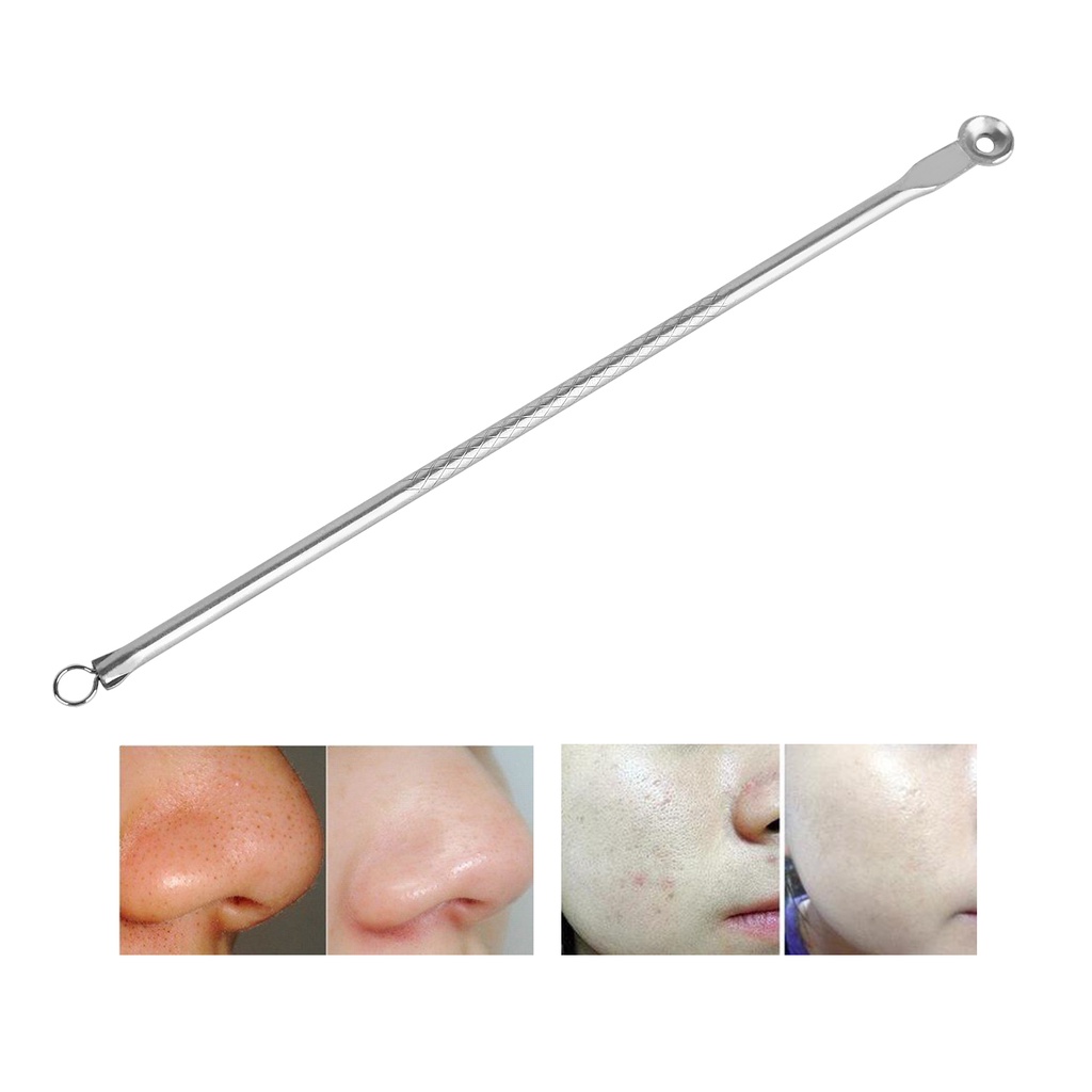 Kim Lấy Mụn Đầu Đen Bằng Thép Không Gỉ Tiện Dụng
